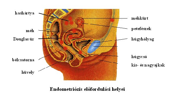 ha széklet kerül a hüvelybe